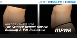 how does emsculpt neo work